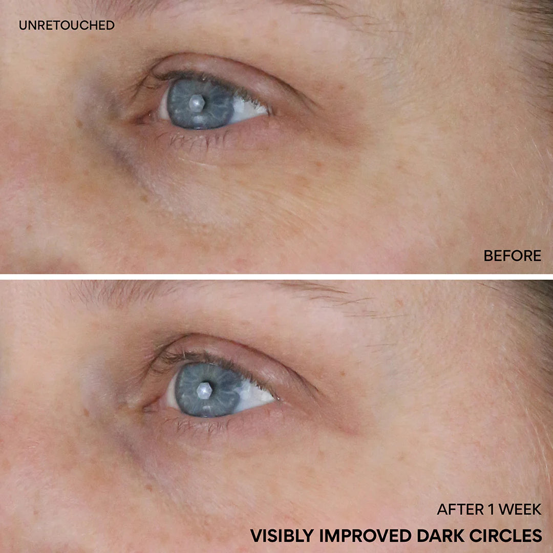 Suero iluminador contorno de ojos con niacinamida y vitamina C | Innisfree