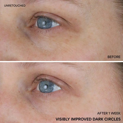 Suero iluminador contorno de ojos con niacinamida y vitamina C | Innisfree