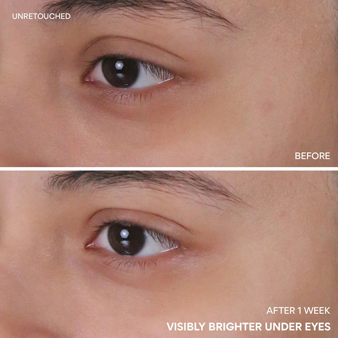 Suero iluminador contorno de ojos con niacinamida y vitamina C | Innisfree