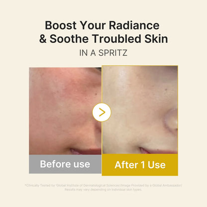 Kojic acid turmeric vita jelly mist serum | Medicube
