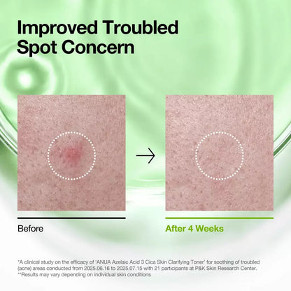 Tónico Azelaic Acid 3 + Cica | Anua