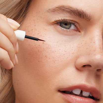 Freck og | The original freckle